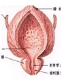 前列腺疾病